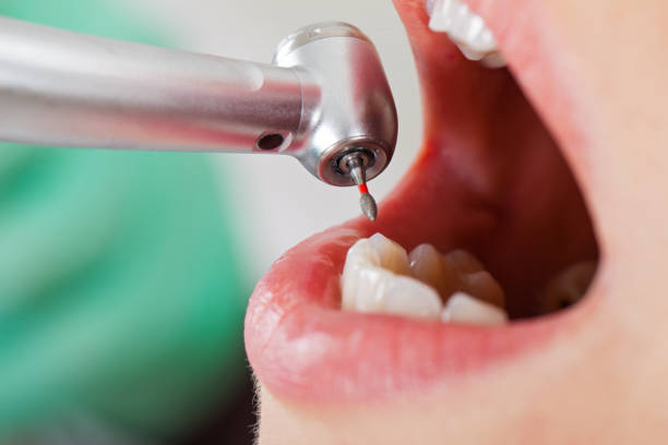 Best Cracked Tooth Emergency Dentist  in Ocean Bluff Brant Rock, MA